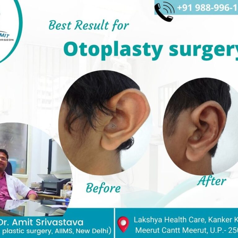 Best Cosmetic Surgeon in Meerut (10)