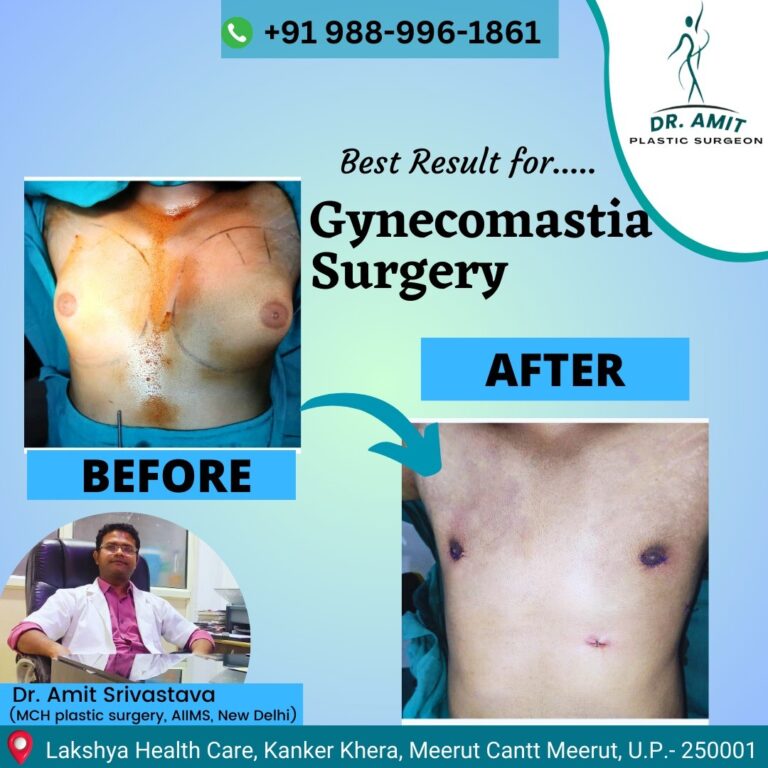 Best Cosmetic Surgeon in Meerut (11)