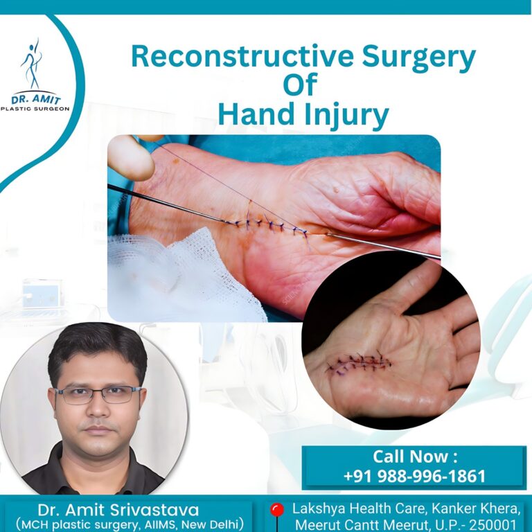 Best Cosmetic Surgeon in Meerut (12)