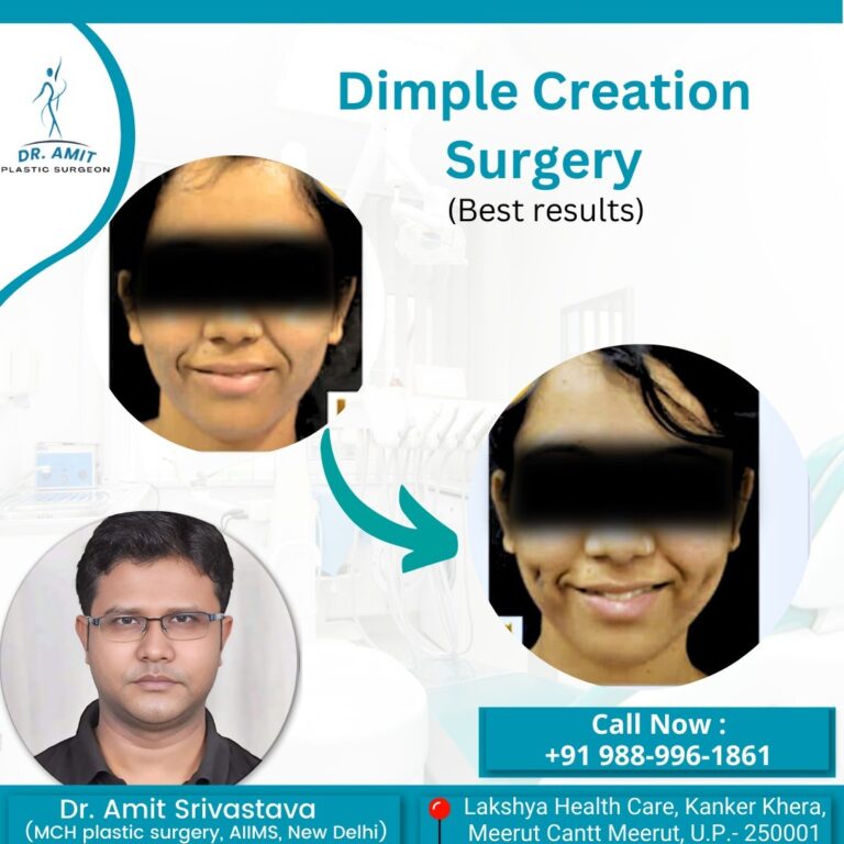 Best Cosmetic Surgeon in Meerut (13)