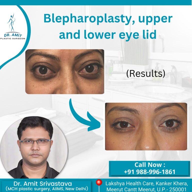 Best Cosmetic Surgeon in Meerut (14)