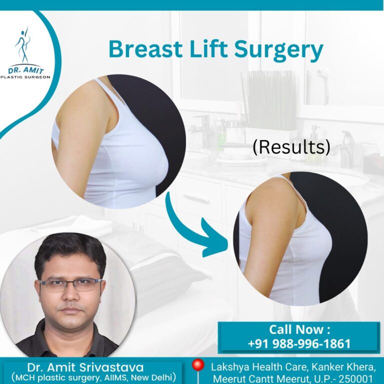 Best Cosmetic Surgeon in Meerut (15)