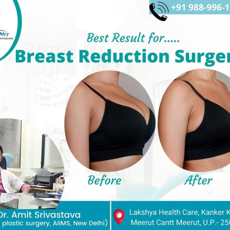 Best Cosmetic Surgeon in Meerut (2)