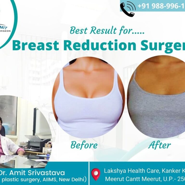 Best Cosmetic Surgeon in Meerut (3)