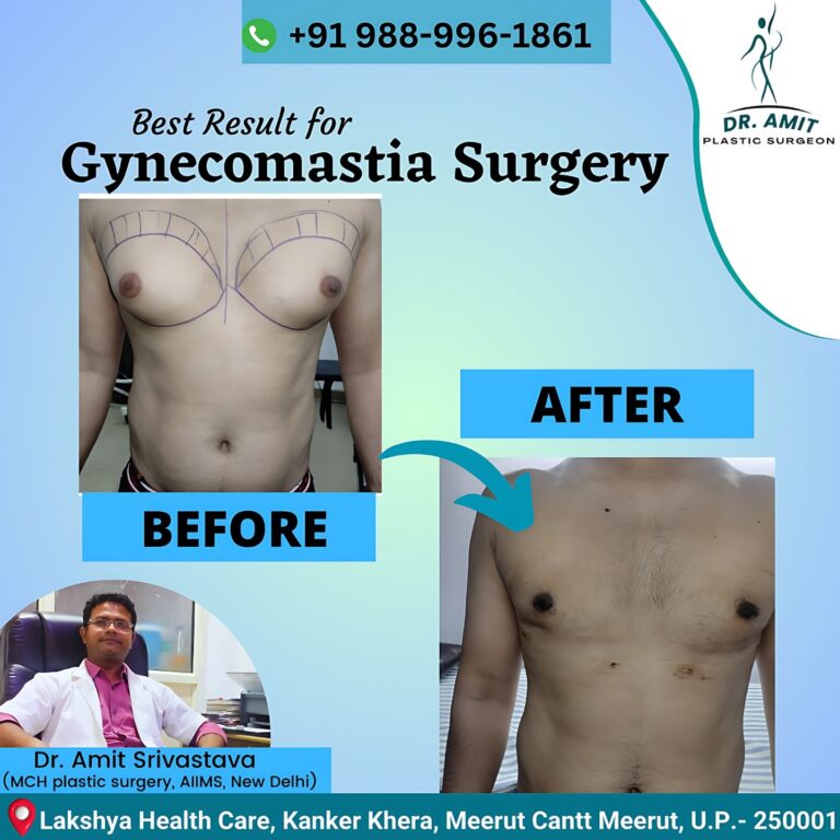 Best Cosmetic Surgeon in Meerut (5)