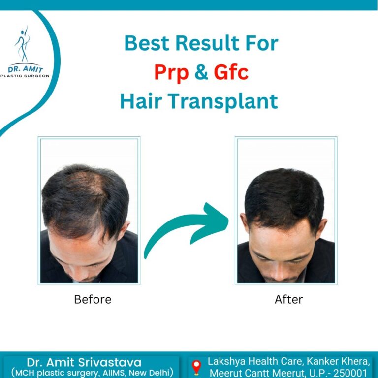 Best Cosmetic Surgeon in Meerut (6)