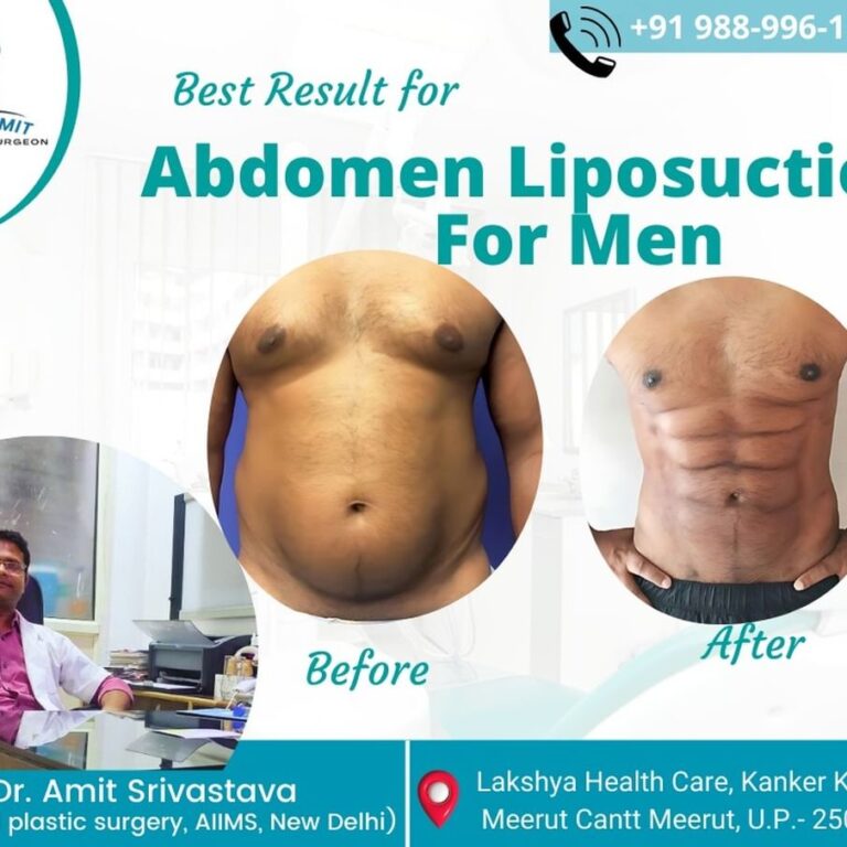 Best Cosmetic Surgeon in Meerut