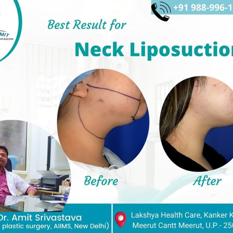 Best Cosmetic Surgeon in Meerut (8)