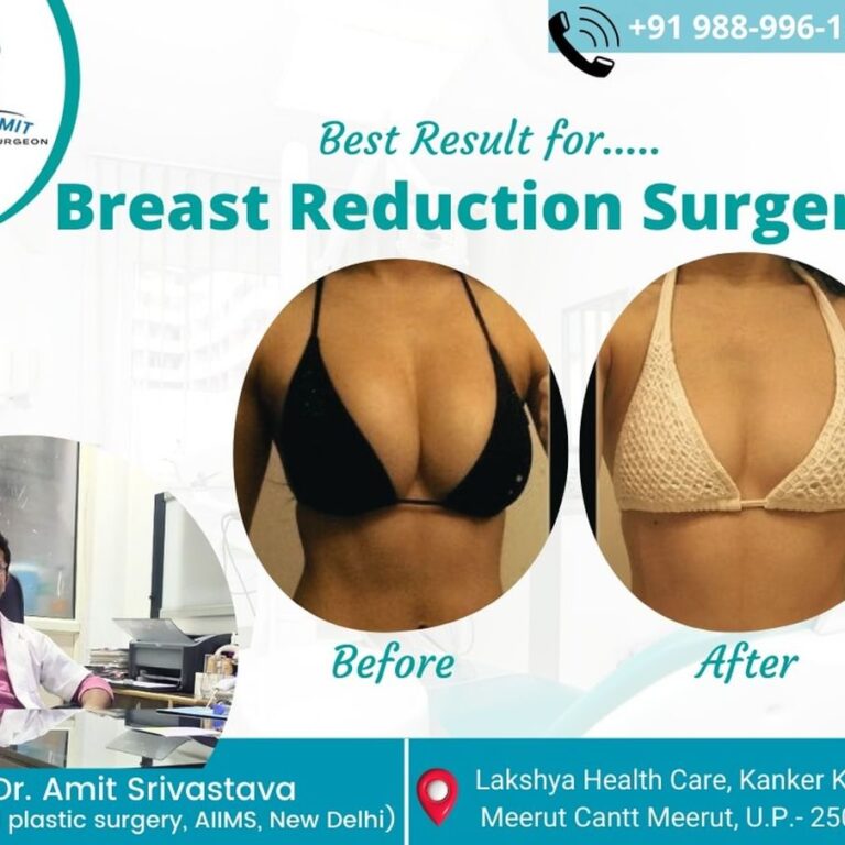 Best Cosmetic Surgeon in Meerut (Plastic Surgeon)