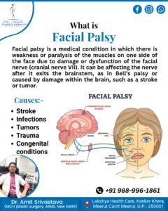 What is Facial Plasty by “Best Plastic Surgeon in Meerut”